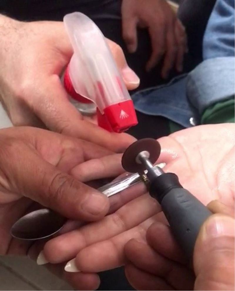 Yüzüğü parmağından çıkaramadı, soluğu itfaiyede aldı